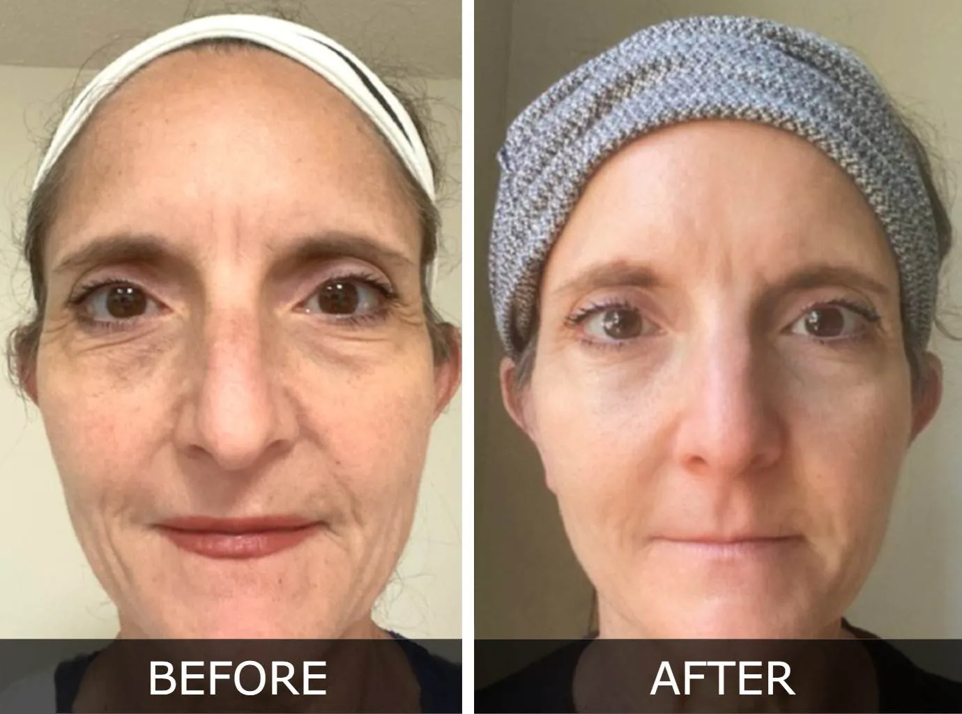 Total Package Serum under-eye skin appearance comparison